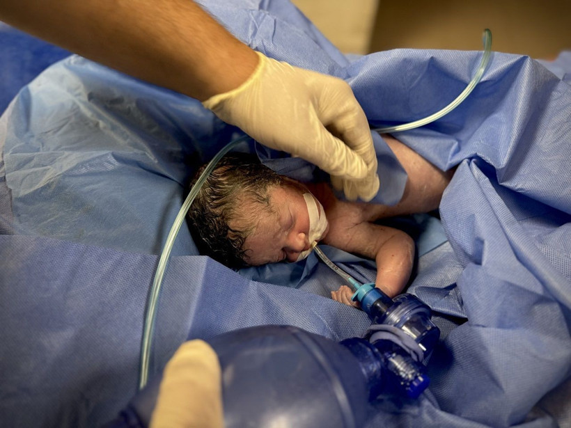 Katliam kan dondurmaya devam ediyor! Saldırıda ölen hamile kadının bebeği kurtarıldı - Resim: 2