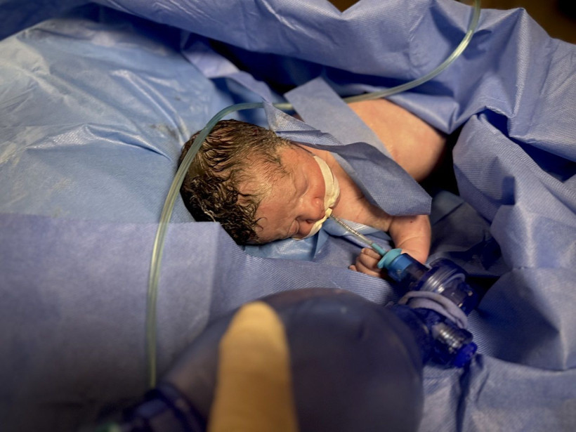 Katliam kan dondurmaya devam ediyor! Saldırıda ölen hamile kadının bebeği kurtarıldı - Resim: 3