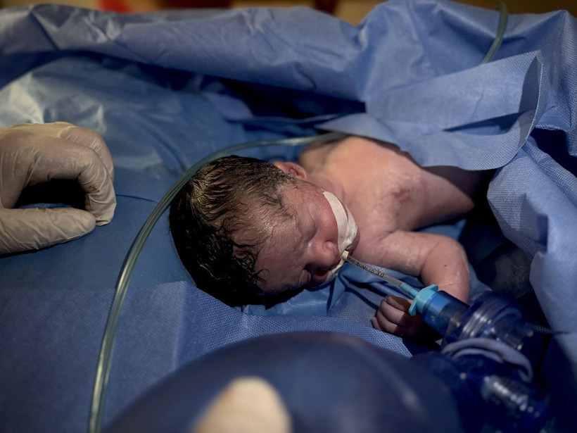 Katliam kan dondurmaya devam ediyor! Saldırıda ölen hamile kadının bebeği kurtarıldı - Resim: 4