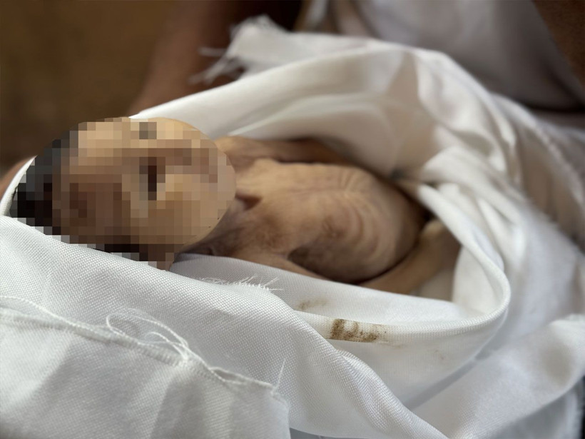 Gazze'de 5 aylık bir bebek açlıktan öldü! Kıyamet kopmalıydı ama dünya suskun - Resim: 3