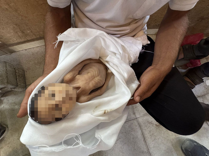 Gazze'de 5 aylık bir bebek açlıktan öldü! Kıyamet kopmalıydı ama dünya suskun - Resim: 4