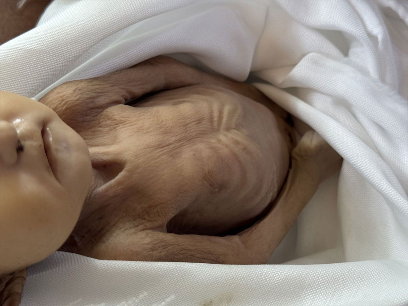 Gazze'de 5 aylık bir bebek açlıktan öldü! Kıyamet kopmalıydı ama dünya suskun - Resim: 1