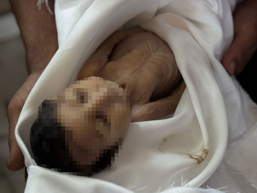 Gazze'de 5 aylık bir bebek açlıktan öldü! Kıyamet kopmalıydı ama dünya suskun - Resim: 2