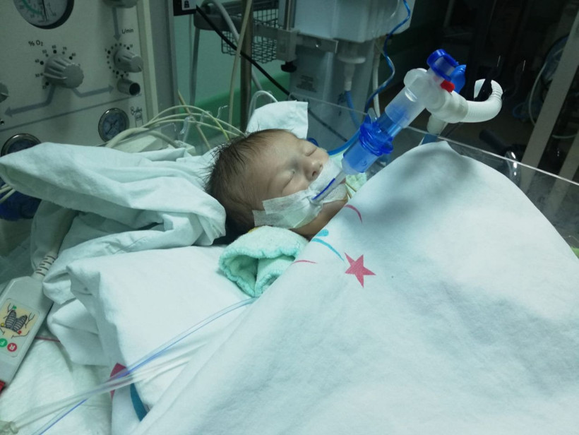 Ankara'da 12 günlük bebeğe yapay 3,5 milimetrelik yapay damar takıldı - Resim: 1