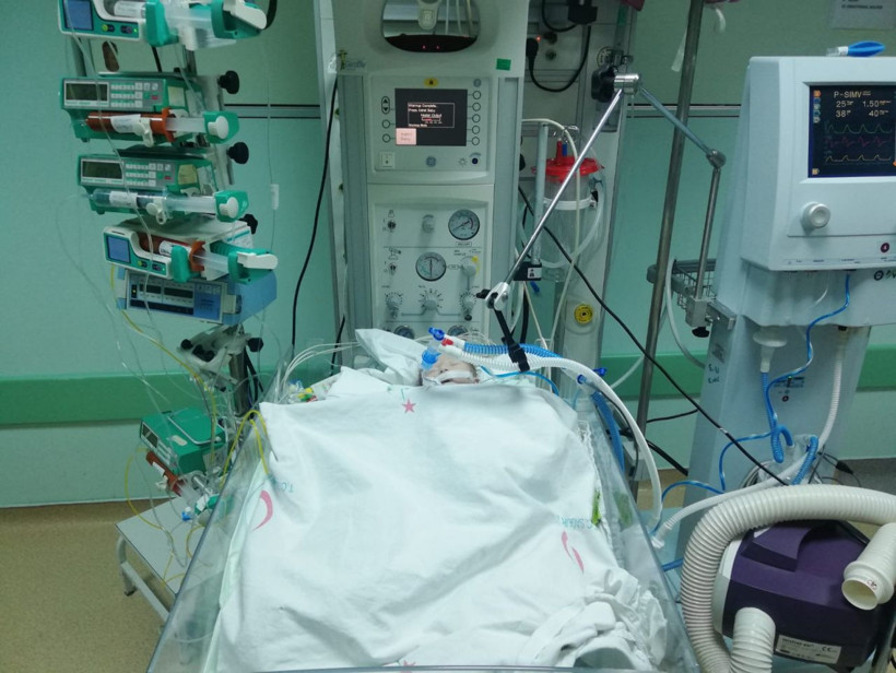 Ankara'da 12 günlük bebeğe yapay 3,5 milimetrelik yapay damar takıldı - Resim: 2