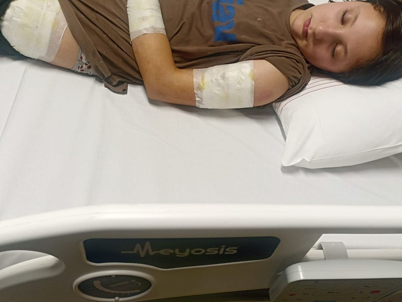 Şanlıurfa'da sokak köpeği saldırısı! Kız çocuğunu resmen parçalamışlar - Resim: 4