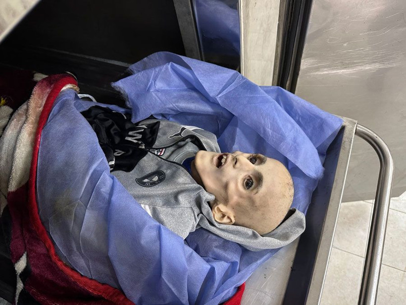 Gazze'de yetersiz beslenme sonucu ölen Filistinli çocuktan geriye bir deri bir kemik fotoğrafları kaldı - Resim: 4