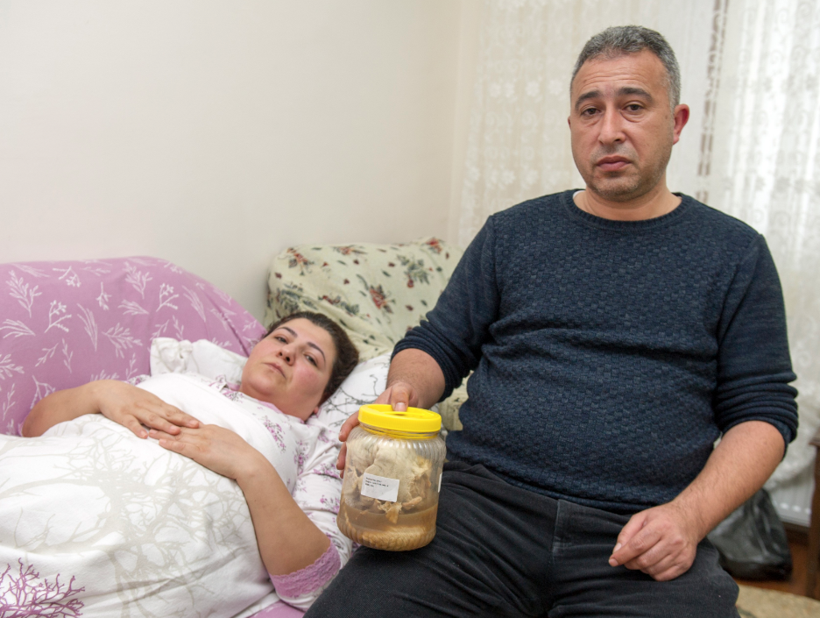 Kanser olabilirsin denildi, karnından çıkanlar şoke etti - Resim: 1