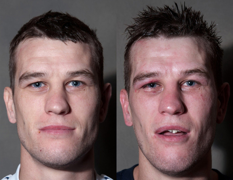 Boksörlerin öncesi ve sonrası fotoğrafları - Resim: 3