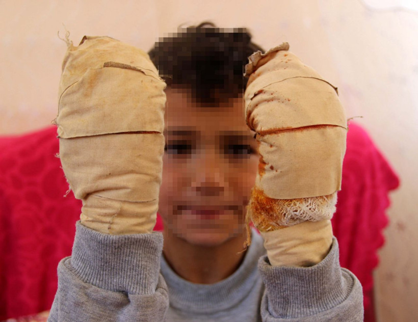 Küçük çocuğu yemek bile yiyemeyecek hale getirdi - Resim: 1