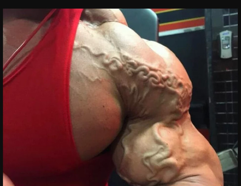 Damarlarınız diğer insanlara çok belirginse dikkat - Resim: 2