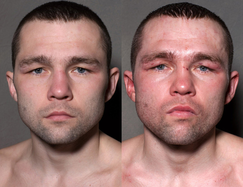 Boksörlerin öncesi ve sonrası fotoğrafları - Resim: 2