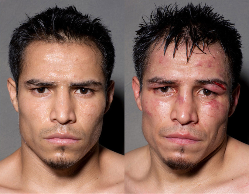 Boksörlerin öncesi ve sonrası fotoğrafları - Resim: 1