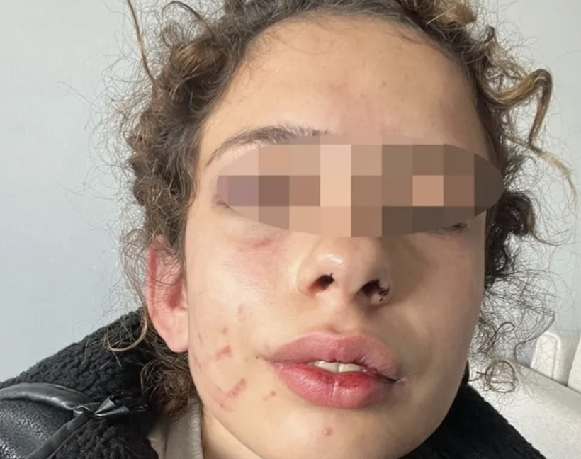 Üniversiteli kıza dehşeti yaşattı! 'Sana bir sürprizim var' dedi sabaha kadar dövdü - Resim: 2