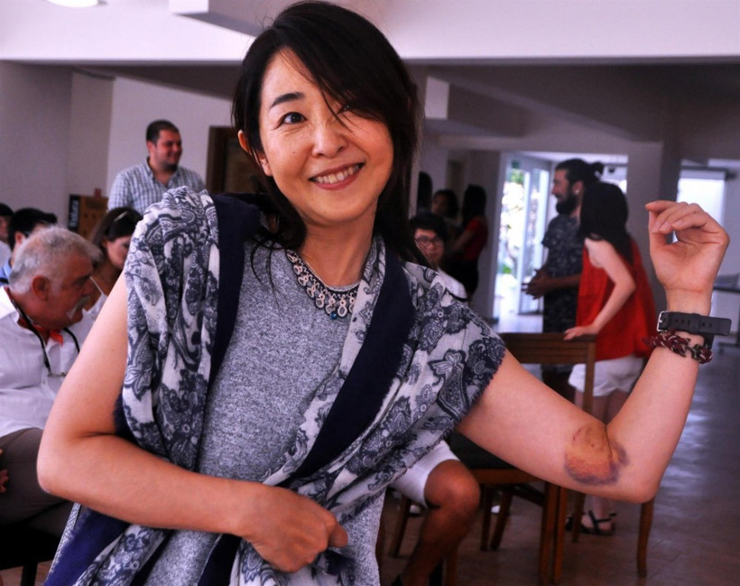 Caretta carettalar ısırdı onlar böyle poz verdi - Resim: 4