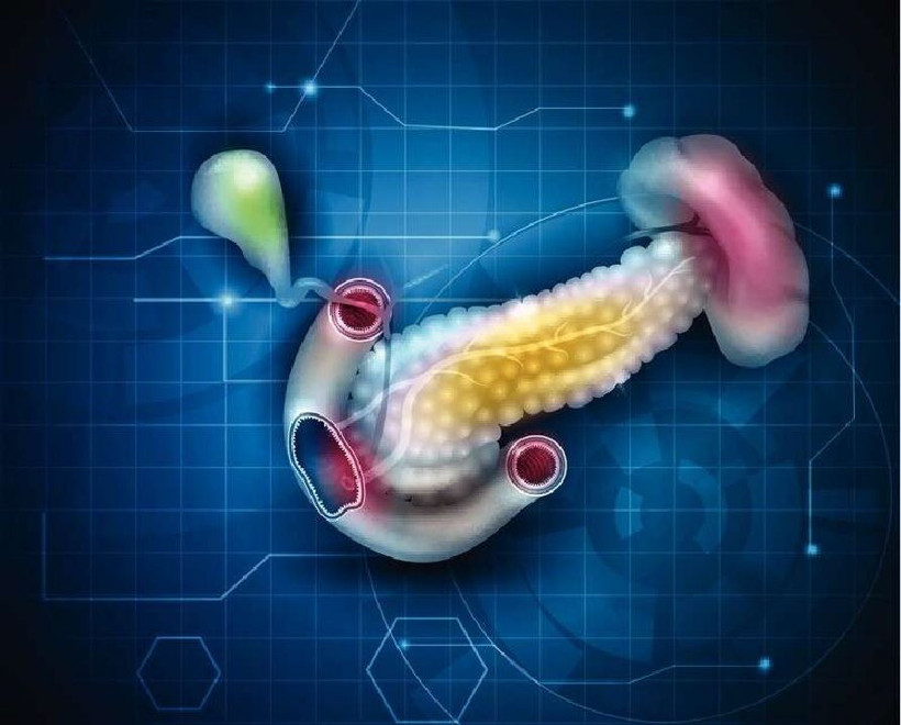 Artık çaresiz değil! Pankreas kanserine "olağanüstü aşı" bulundu! - Resim: 4