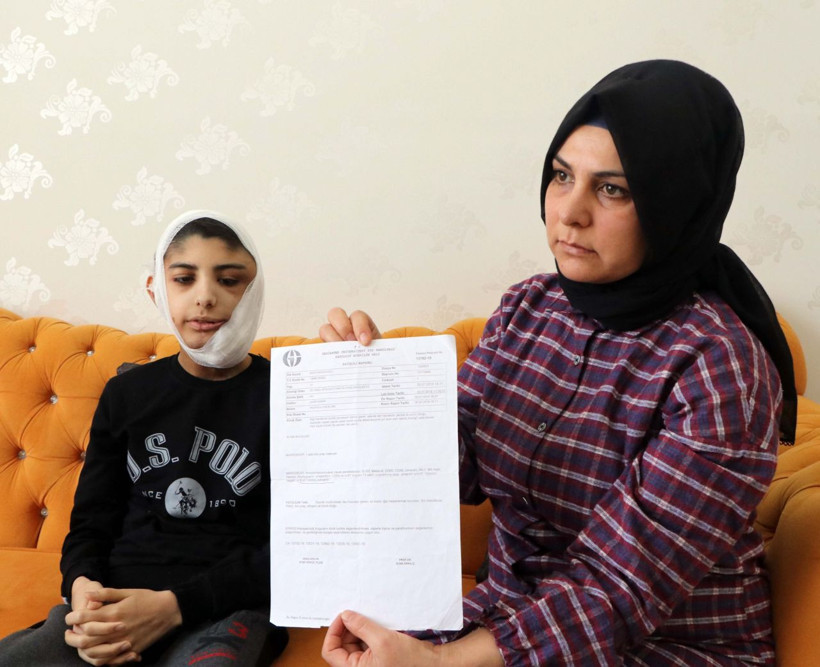 Gaziantep'te yüzünde çıktı bir daha kapanmadı! Berat'ın yarası her gün büyüyor - Resim: 2