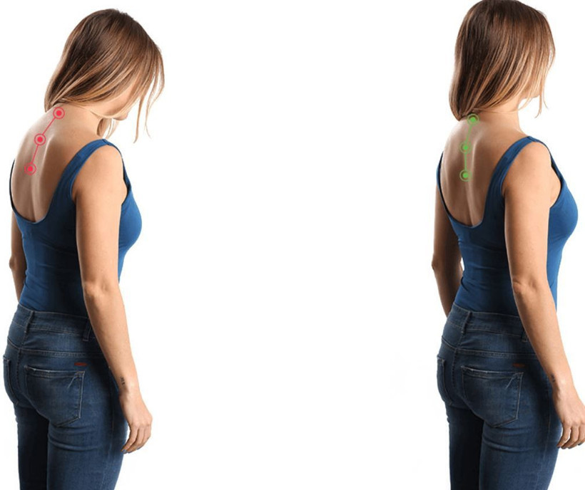 Dik duruş için bunları yapın kamburluğu önlüyor! - Resim: 1