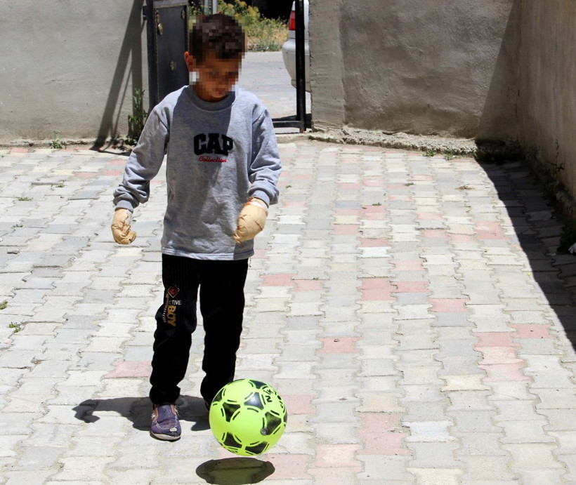 Küçük çocuğu yemek bile yiyemeyecek hale getirdi - Resim: 3