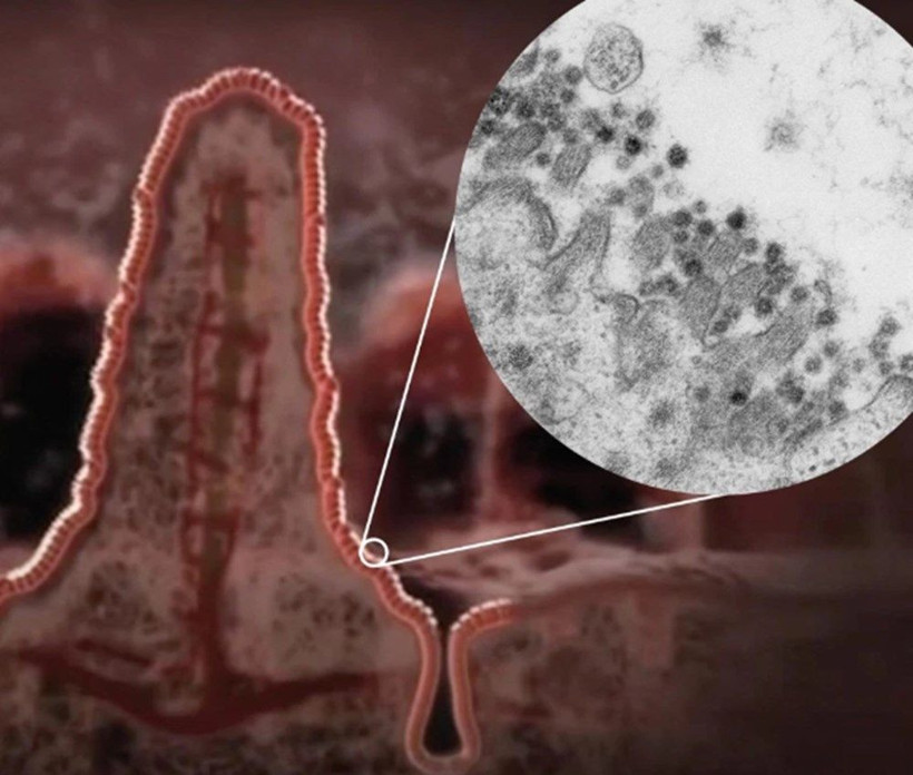 Koronavirüsün detaylı ve yüksek çözünürlüklü görüntüleri ilk kez yayımlandı - Resim: 3