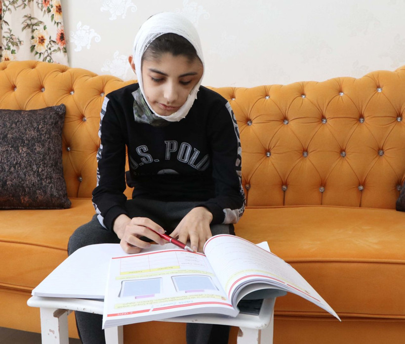 Gaziantep'te yüzünde çıktı bir daha kapanmadı! Berat'ın yarası her gün büyüyor - Resim: 4