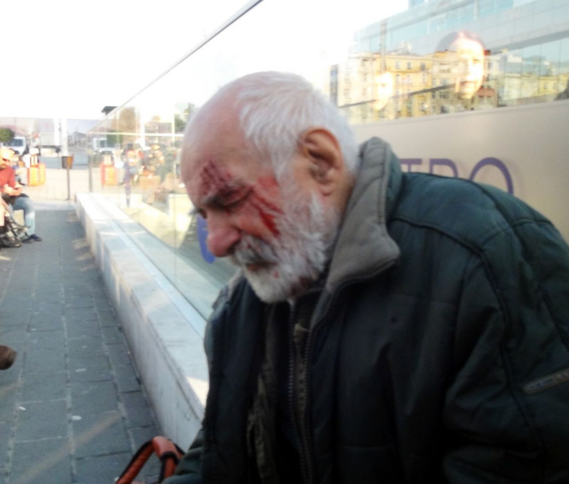 Oyuncu Hikmet Karagöz Taksim Metrosunda merdivenlerden düştü kanlar içinde kaldı - Resim: 4