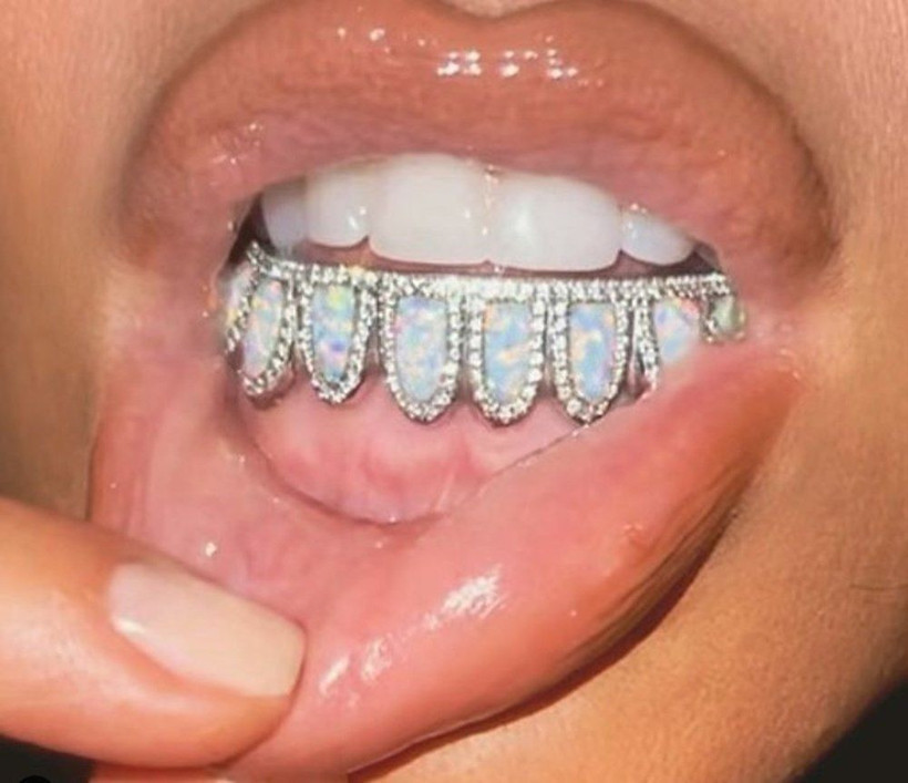 Kim Kardashian 5 bin dolarlık diş mücevheri yaptırdı gören şaştı kaldı - Resim: 2