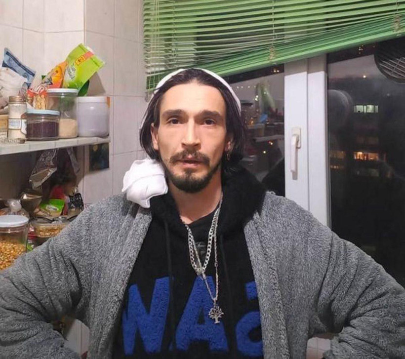 Cinsiyet değiştirmişti! Çukur'un 'Timsah Celil'i Ahmet Melih Yılmaz aylık hormon masrafını açıkladı - Resim: 2