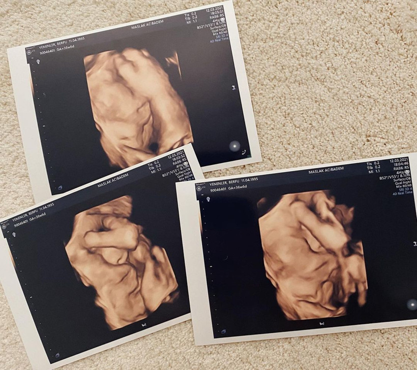 Berfu Yenenler 'Yakın olması şoku' deyip Eser Yenenler'le paylaştı! Herkesi güldürdü - Resim: 3