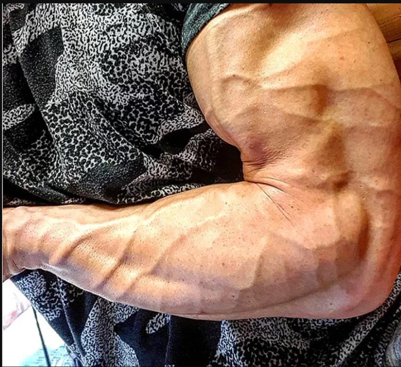 Damarlarınız diğer insanlara çok belirginse dikkat - Resim: 4