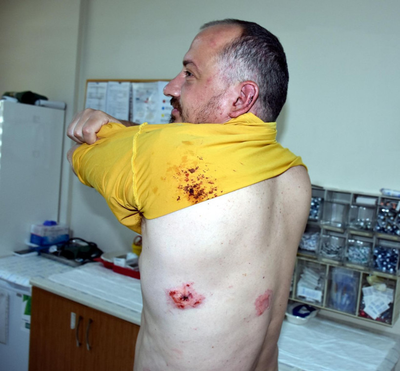 Ünlü gezgin Fatih Koparan'ı feci dövdüler : Beni öldürecekler - Resim: 3