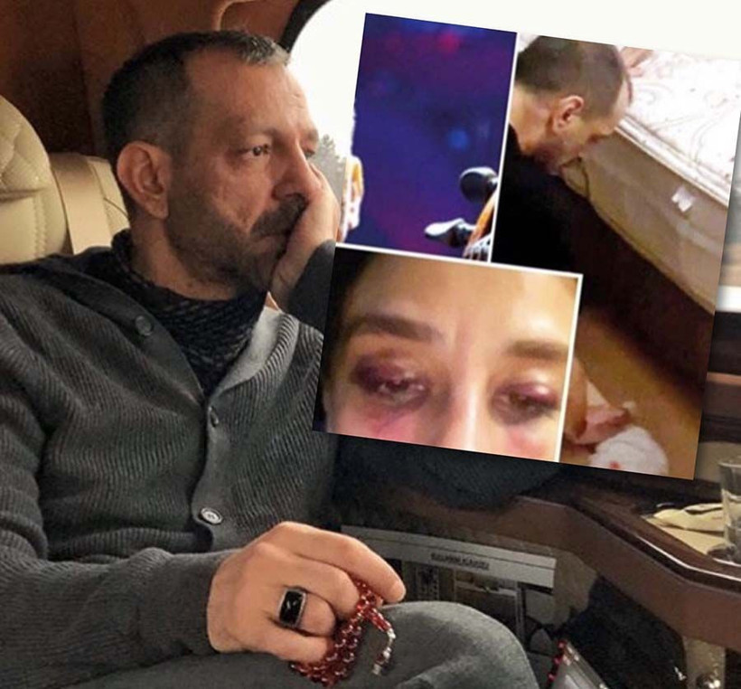 Rubato solisti Özer Arkun'un sevgilisi Burcu Yılmaz'a şiddet davasında yeni gelişme - Resim: 4