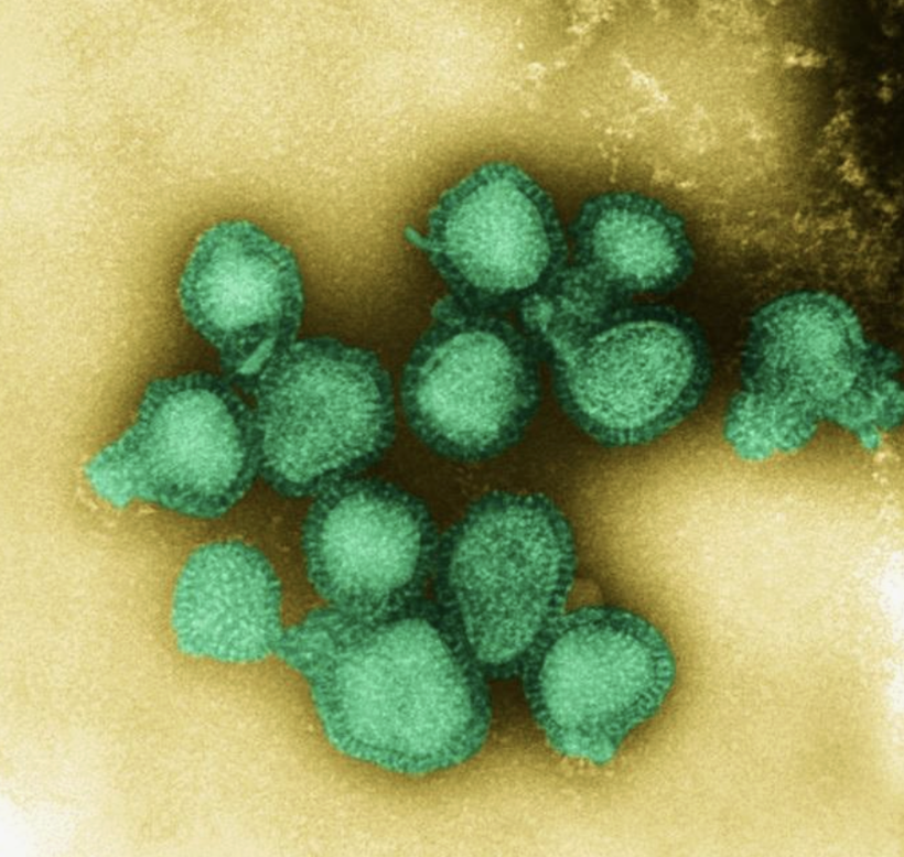 Avrupa'dan sonra Türkiye'de tehdit altında! Ölümlere neden oluyor... - Resim: 3