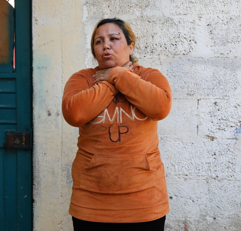 Cinsel şiddet kabusu! 'Kocam gelinliğimi yırtıp birlikte oldu' dedi: Gürültüyü duyan koştu defalarca... - Resim: 1