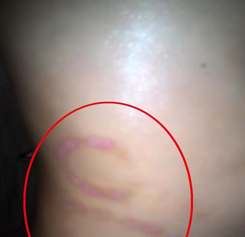 Eli matkapla delindi ısırıldı Van Gölü'ne atıldı! Mucize kurtuluşu anlattı - Resim: 3