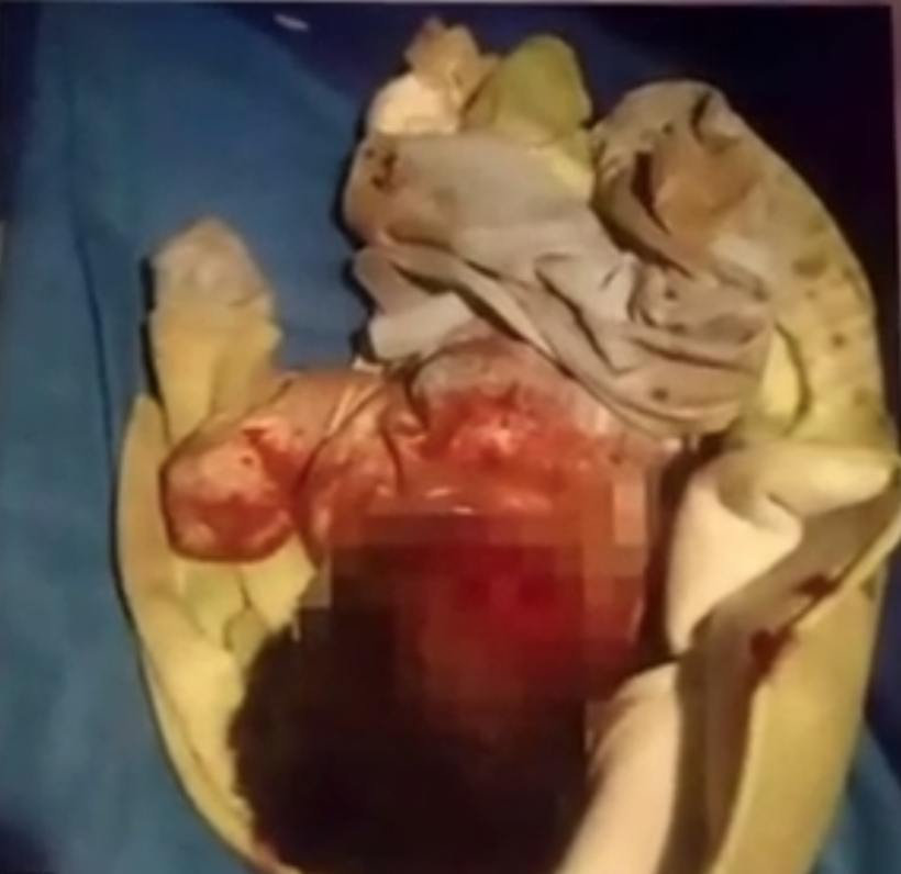 Yenidoğan bebeği sokağa bıraktı köpekler paramparça etti! - Resim: 2