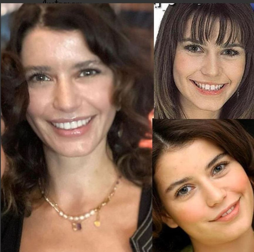 Beren Saat dişlerini yaptırdı sosyal medyada hayranları ikiye bölündü - Resim: 1