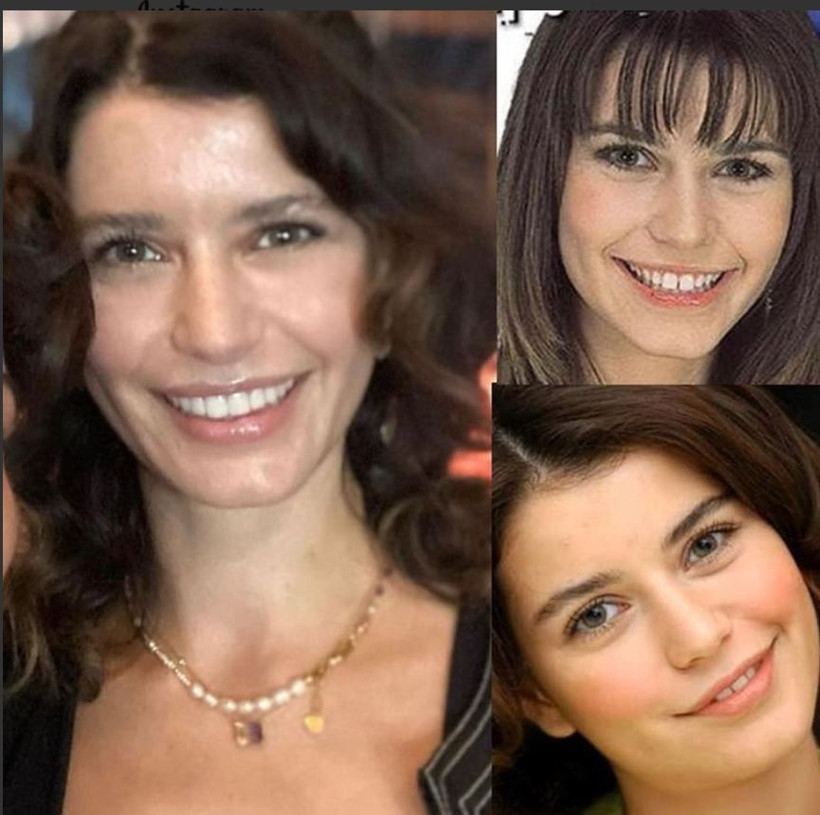 Beren Saat kaç yaşında son haliyle bu soruyu sordu hiç yaşlanmıyor - Resim: 2