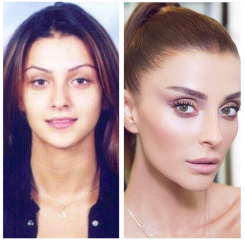 Melis Sezen Pınar Deniz Gülsim Ali'nin estetiksiz hallerine bakın! Ünlüleri eski hallerini gören tanıyamadı - Resim: 4