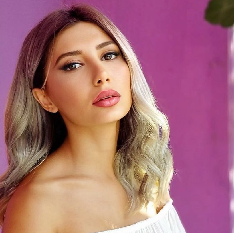 Ceylan'ın kızı Melodi Bozkurt değişimiyle şoke etti! Estetikle bambaşka biri oldu - Resim: 2