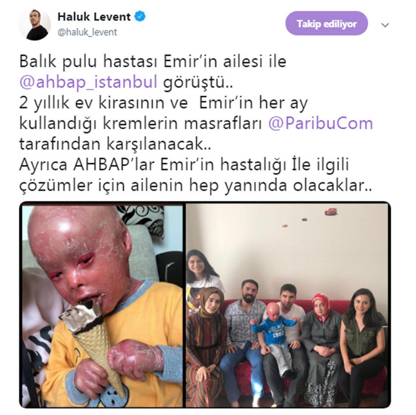 Balık pulu hastası Mehmet Emir'e Haluk Levent'ten büyük destek! - Resim: 4
