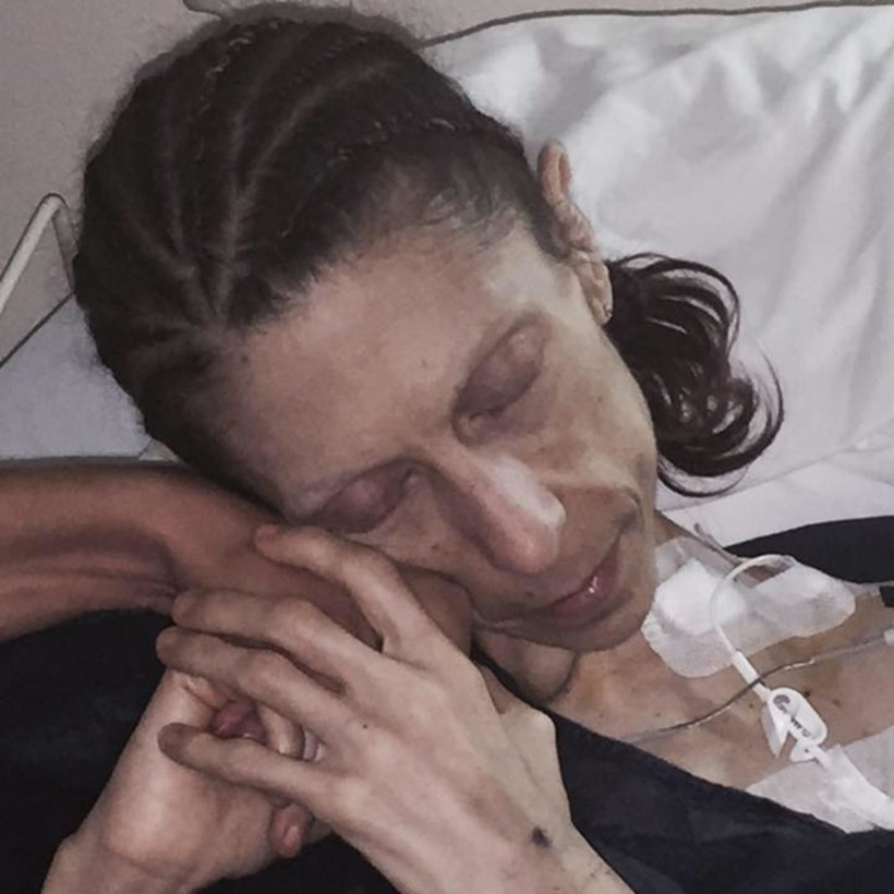 Diyet yapma uğruna... 18 kiloya kadar düştü! - Resim: 3