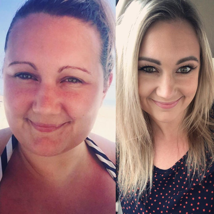 70 yaşında gibi hissediyordu! Onu bir de şimdi görün Son hali fena - Resim: 2