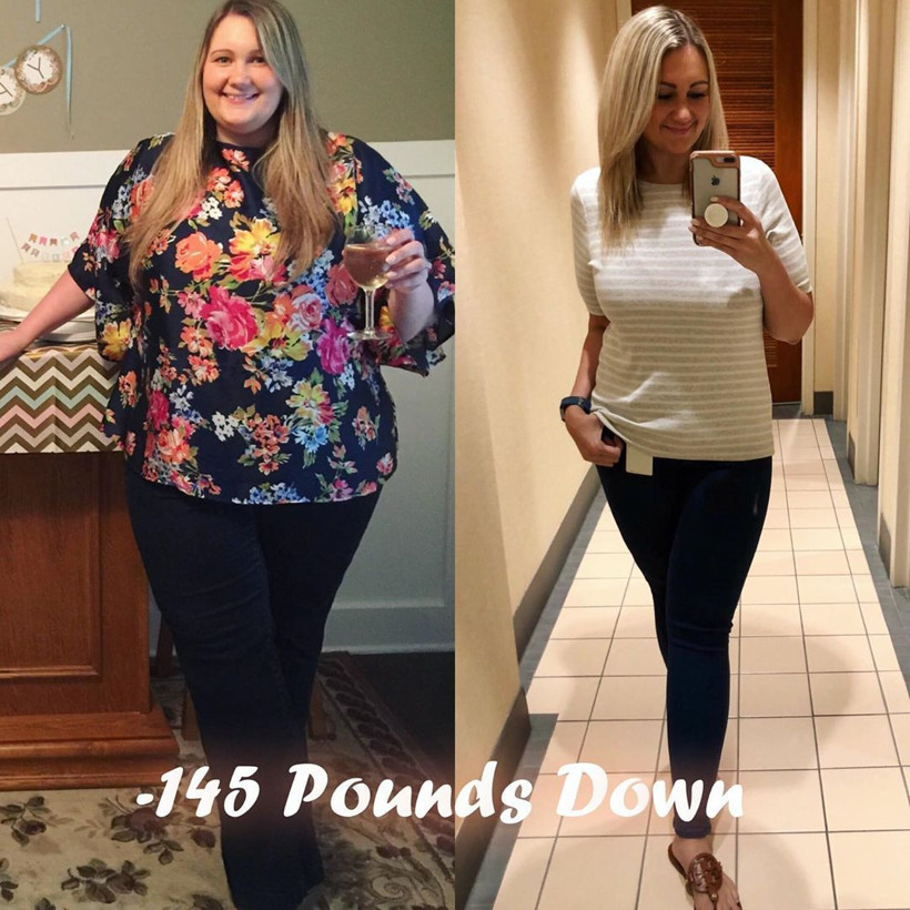 70 yaşında gibi hissediyordu! Onu bir de şimdi görün Son hali fena - Resim: 1