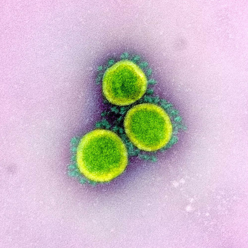 Koronavirüsün insan hücrelerinde yayılışı görüntülendi! Bu ne hız böyle - Resim: 2