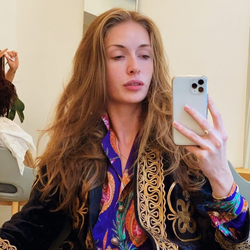 Yasemin Allen'in son hali görenleri şaşkına çevirdi! Hayranları 'bir daha yapma' yorumunu yaptı - Resim: 4