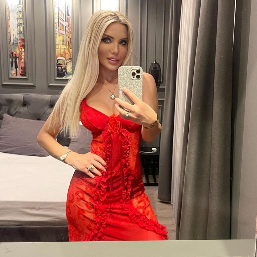 Kemik yaşı bakın kaç çıktı! Taciz rezaletinde 'elbisem yırtılmış' diyen Ciciş Esra Ersoy'a şok: Balkondayken yanıma gelip... - Resim: 3