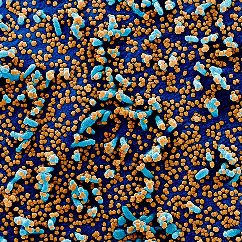 Koronavirüsün insan hücrelerinde yayılışı görüntülendi! Bu ne hız böyle - Resim: 3