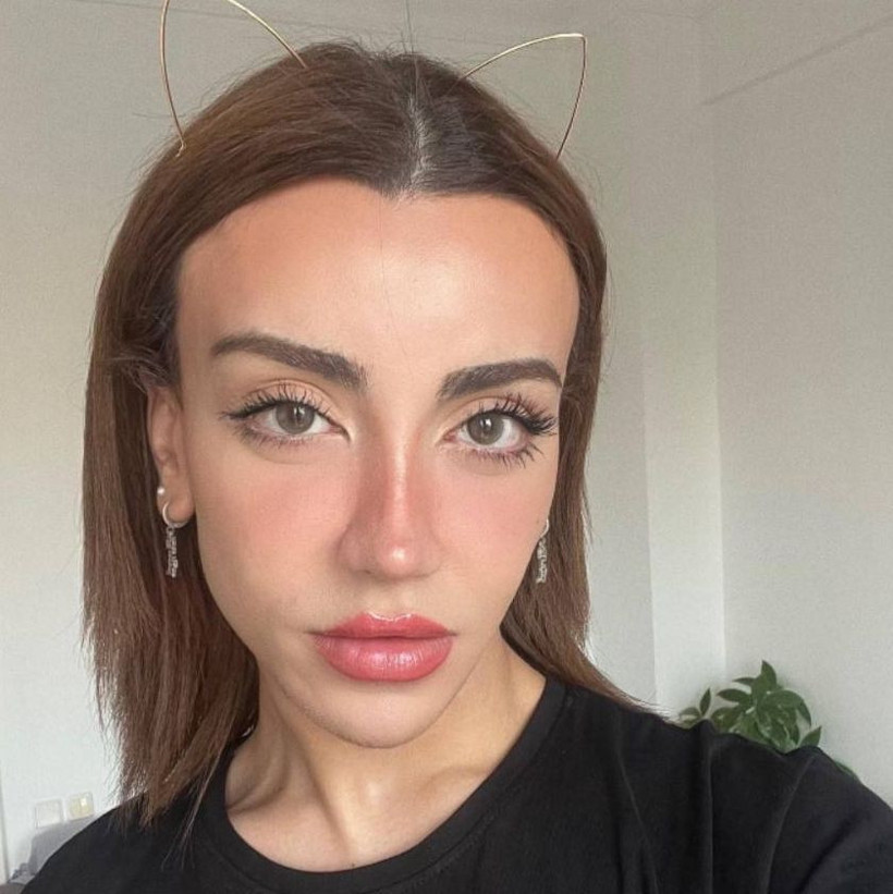 Mika Raun'un son hali görenleri şok etti! Estetik mağduru... - Resim: 3