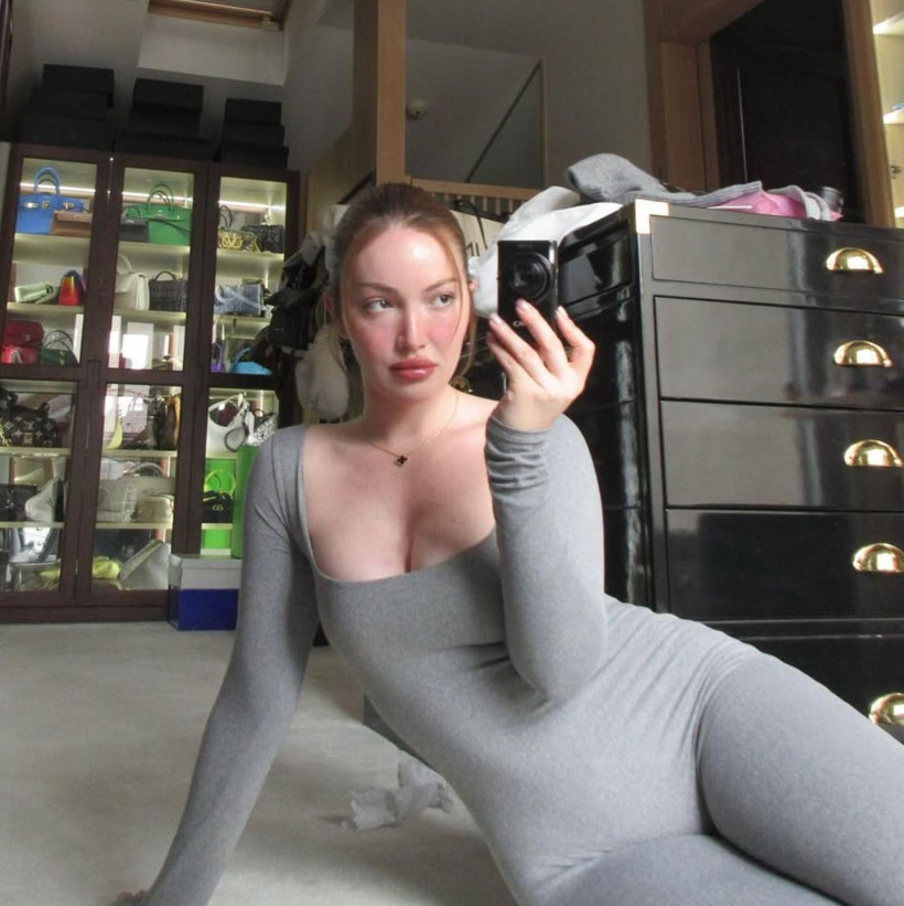 Danla Bilic'ten estetik itirafı: Yalvarıyorum kimse yaptırmasın - Resim: 2